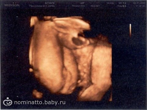 всего размер узи и доплер на 27 неделе отзывы отметить, что