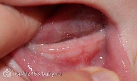 Уши слышать зубы есть Уши слышать зубы есть
