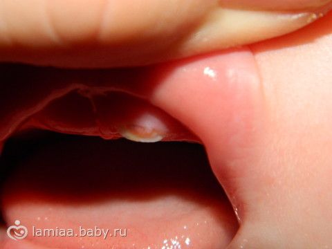 Как собрать кубик рубика пошагово: инструкция для начинающих и Как собрать кубик рубик схема для начинающих 2018