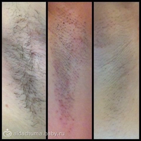 Пирог со щавелем рецепт Отзывы о косметике Avon (Эйвон)