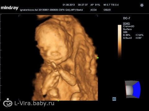 У кого узи долго не показывали беременность У кого узи долго не показывали беременность