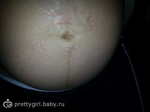 К чему снится беременным бассейн 724 К чему снится беременным бассейн 1146