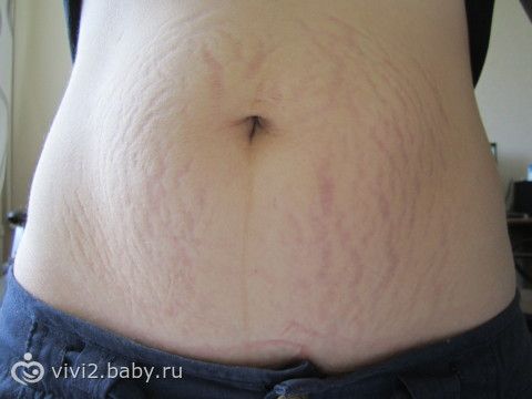 МБУЗ Городская больница 20 Родильное отделение в Ростове-на-Дону Когда укладывать спать на ночь? - Библиотека - Доктор Комаровский
