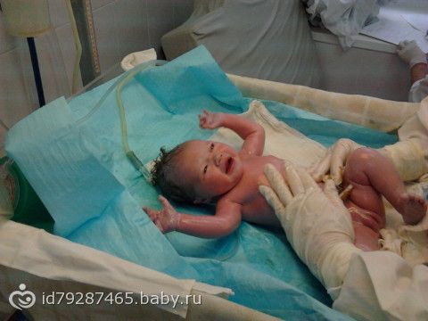 Если роддом переполнен могут ли по прописке не положить? Девчонки, у кого на раннем сроке беременности было кровотечение