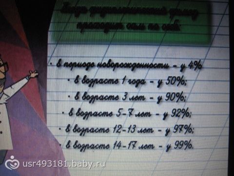 Головка у него всегда открыта Головка у него всегда открыта