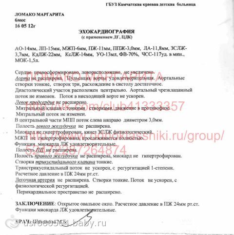 Сбор закрыт. Нужна срочно помощь Маргарите Ломако