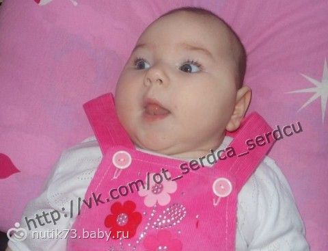 Средства собраны! Ярослава Жунь, 7 месяцев, врожденный гиперинсулинизм. Помогите спасти кроху!