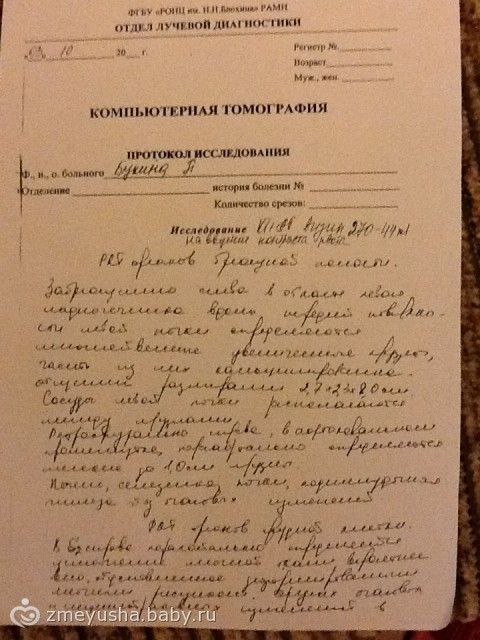 Сбор приостановлен. Полине Букиной нужна ваша помощь! не проходите мимо!
