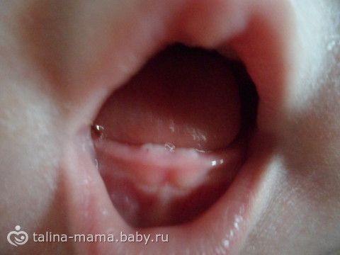 Пятна на коже красного цвета у ребенка фото Пятна на коже красного цвета у ребенка фото