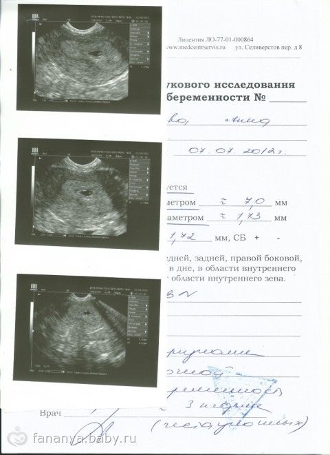 Узи срок 3 недели. УЗИ срок беременности 2-3 недели. Документ УЗИ беременности 3 недели. Справка о беременности на 2-3 неделе беременности. УЗИ 3-5 недели беременности.