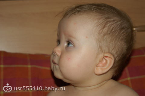 Что за паразиты?!